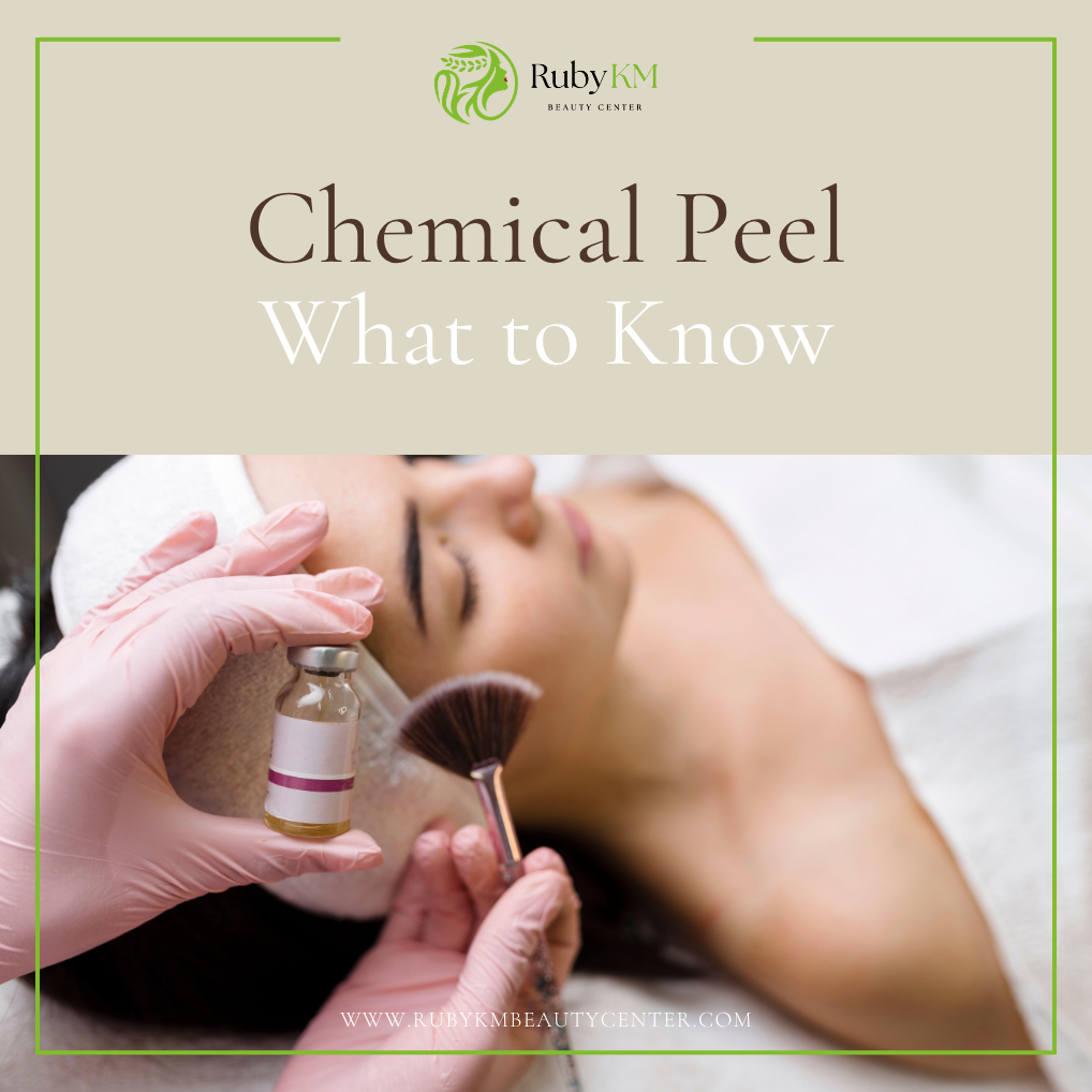 Chemical Peel in Garden Grove_What to Know Before Booking
