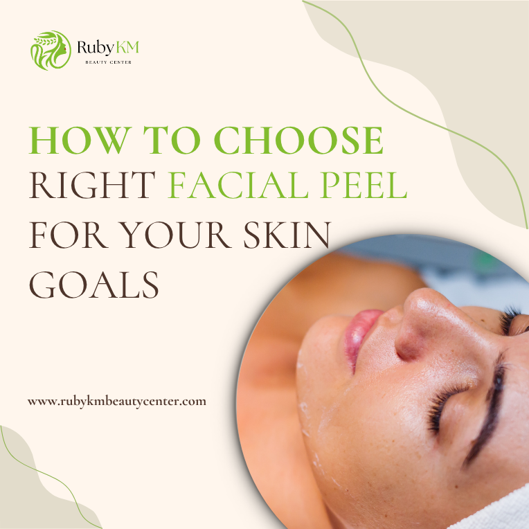 Facial Peel: How to Choose the Right One for Your Skin Goals