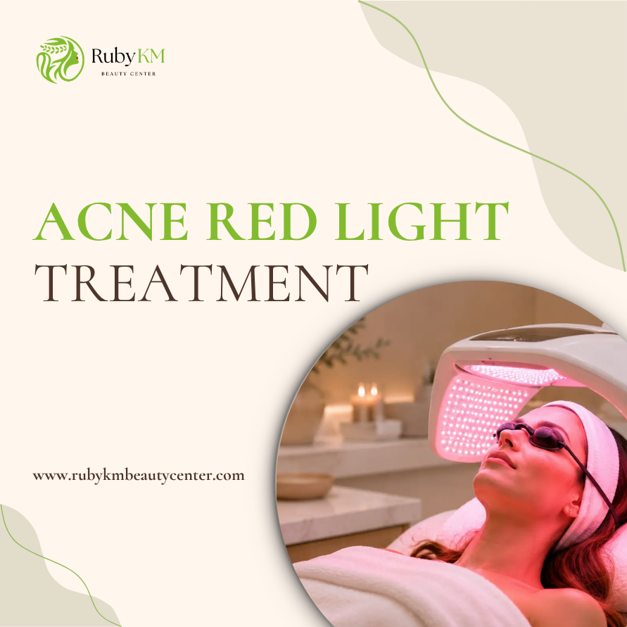 Acne Red Light Treatment: What to Know Before Booking an Acne Facial