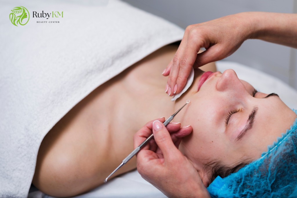 Esthetician performing professional acne extraction on a client's face